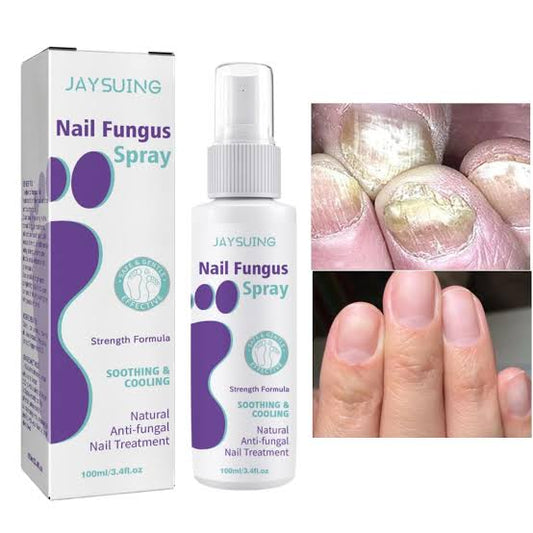 NAIL FINGUS REMOVAL SPRAY